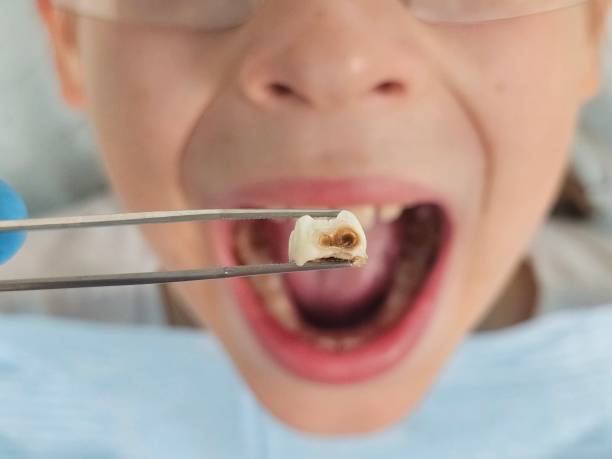 Best Urgent Dental Care in Iowa, LA