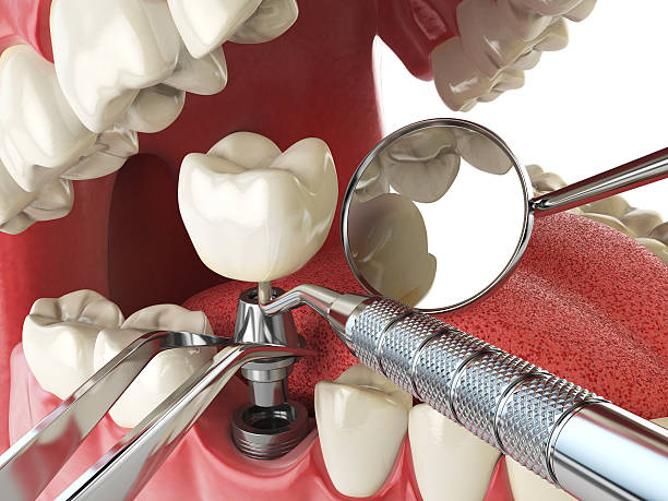 Best Same-Day Emergency Dentist in Iowa, LA